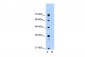SLA antibody - N-terminal region